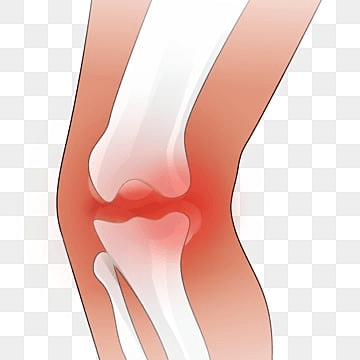 Fracture Management