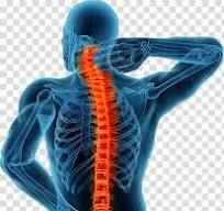 Spinal Fusion and Decompression